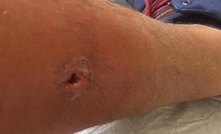 rio 2016 cosa si apetta per togliere la vela da guanabara